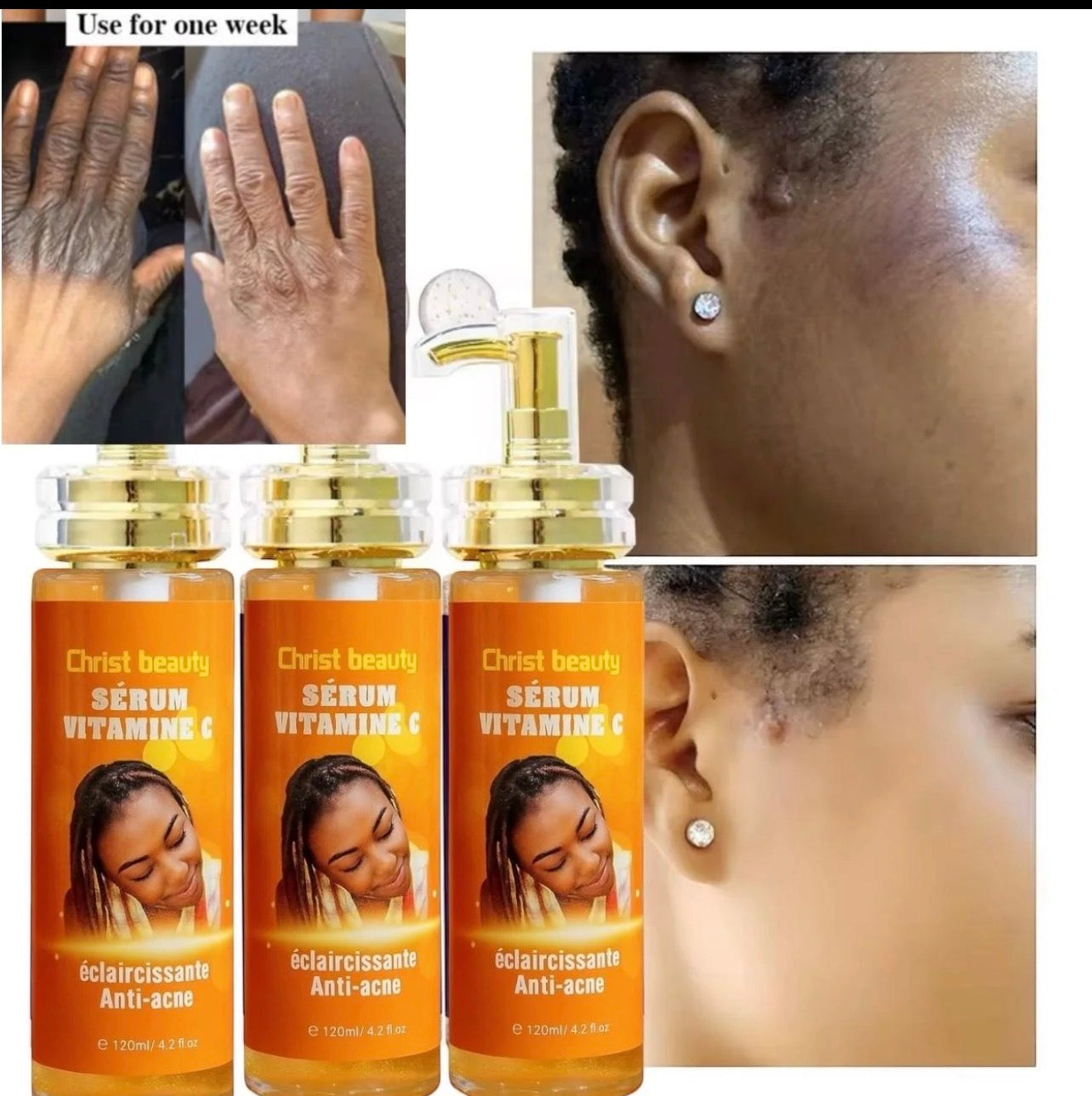 Serum Vitamine