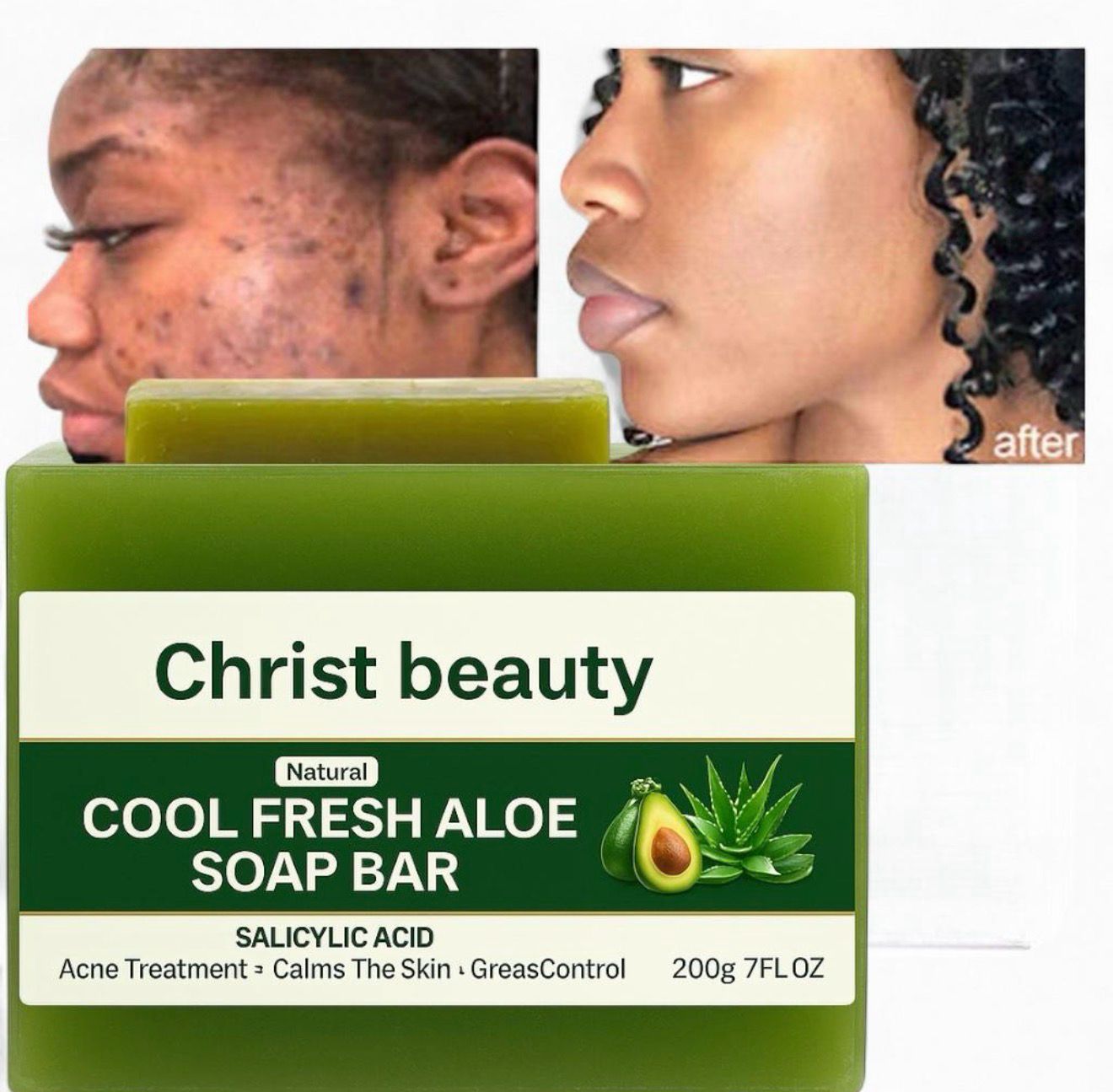 Cool Fresh Aloe Soap Bar with Salicylic Acid – Acne & Grease Control, Calms Irritated Skin, Deep Cleansing 200g/7FL